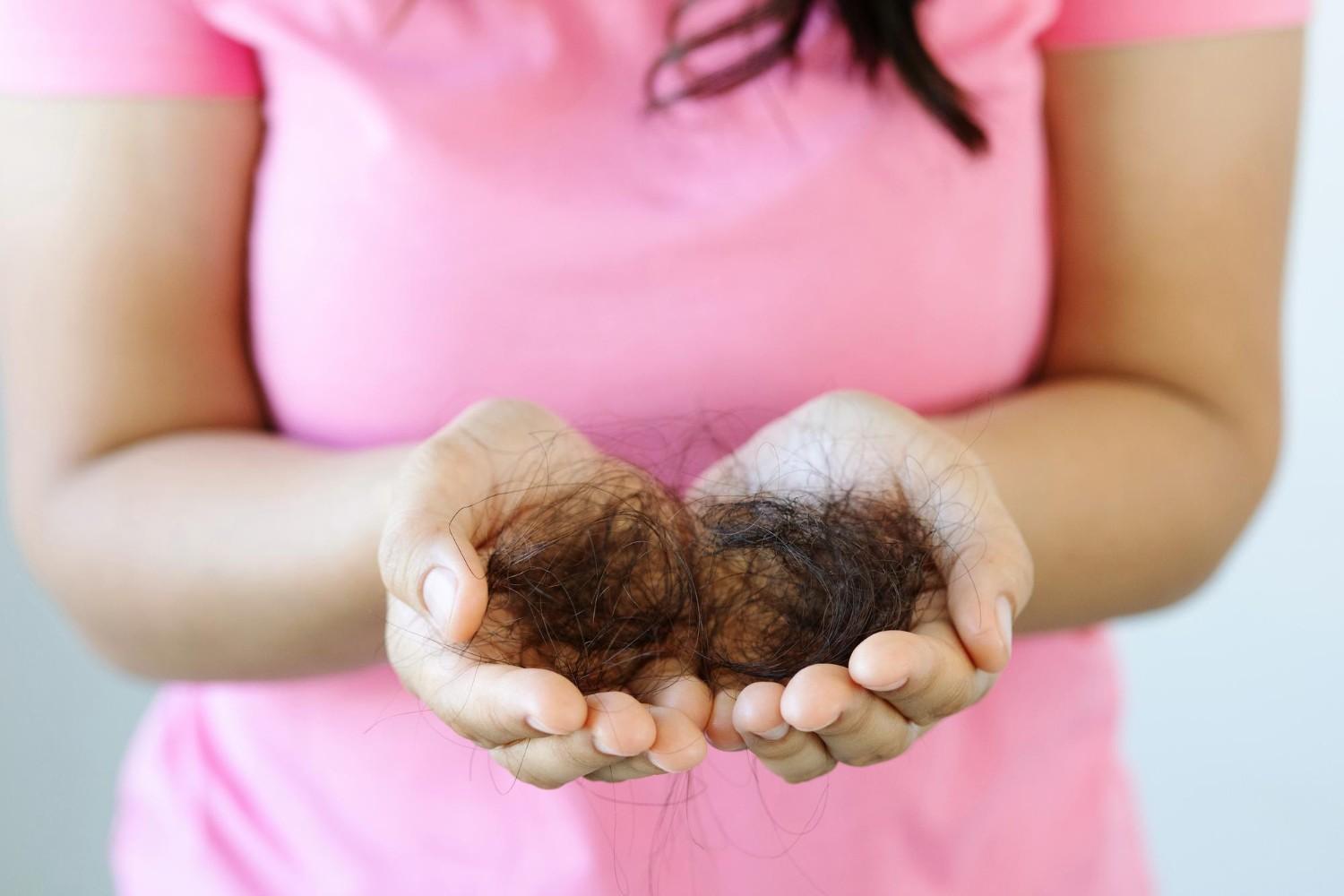 Postpartum Hair Loss: Causes and Recovery Tips