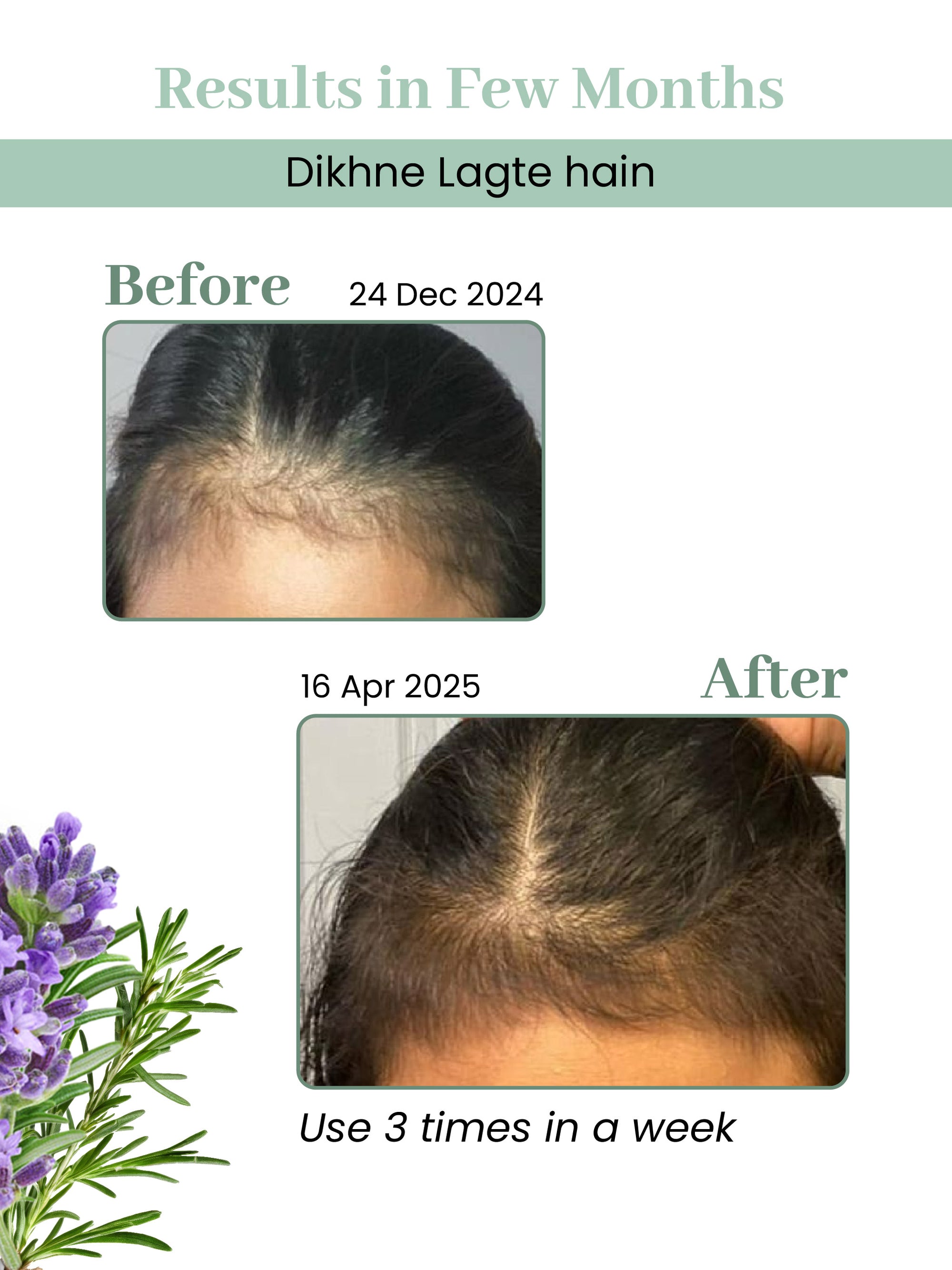 BioBird Rosemary Hair Growth Oil - 100ml