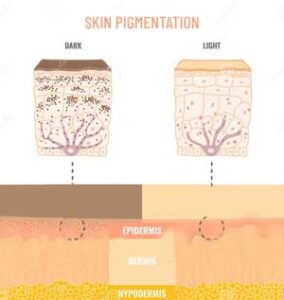 skin-pigmentation-treatment-soap-biobird