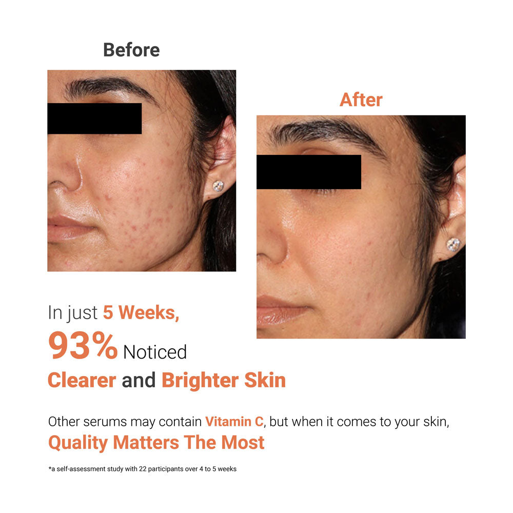 Affordable_Vitamin_C_serum_for_glowing_skin