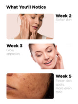 Sunscreen With Niacinamide & Ceramides
